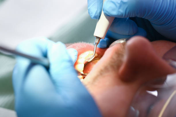 Best Pediatric Emergency Dentist in Fort Drum, NY